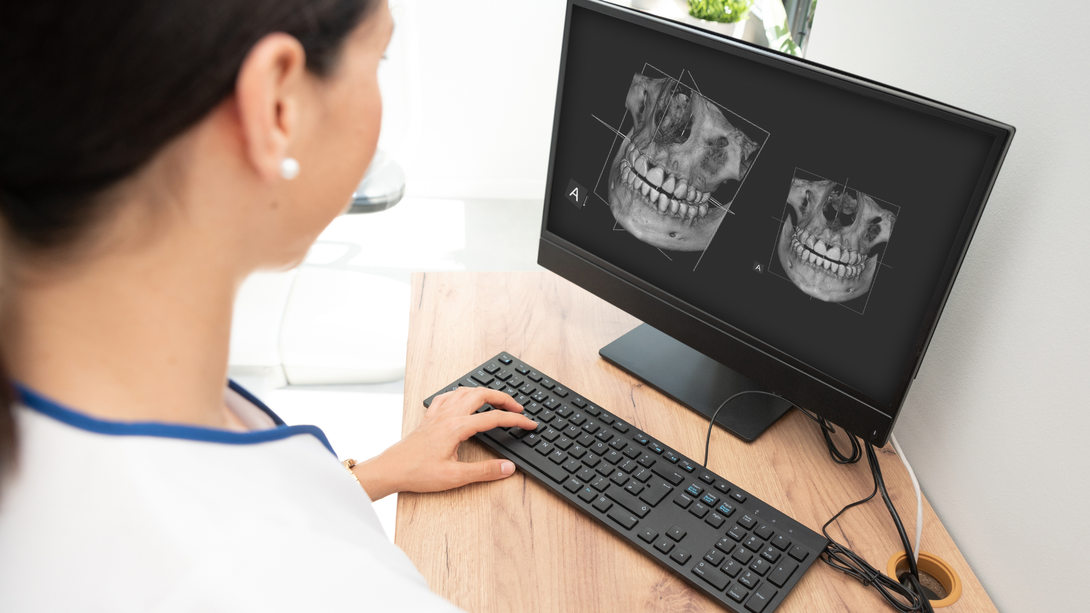 A Importância da Tomografia na Odontologia Moderna de Belo Horizonte